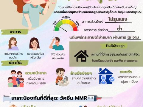 ประชาสัมพันธ์แนวทางป้องกันและควบคุมการระบาดโรคคางทูม